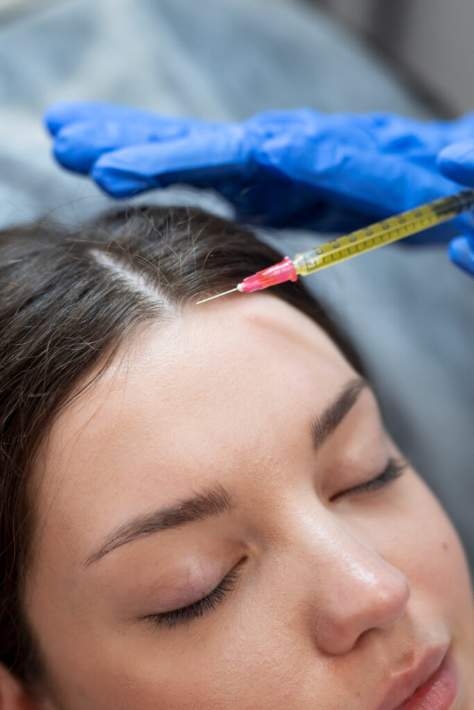 Close-up of forehead injection with syringe by practitioner in blue gloves.